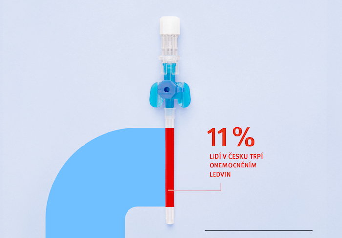 VZP vyzývá kampaní k pravidelné prevenci